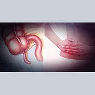 Tzeveleki Ioanna Appendicitis 1