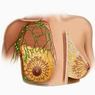 Tzeveleki Surgery breast cancer 3