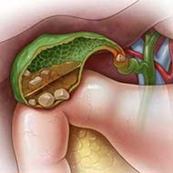 Tzeveleki Surgery symptoms 1